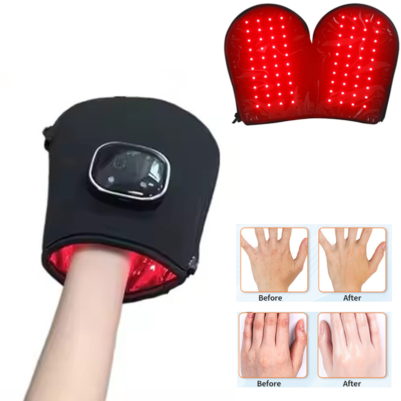Galvanic Skin Sensor - НОВЫЙ Аппарат для светотерапии красным светом