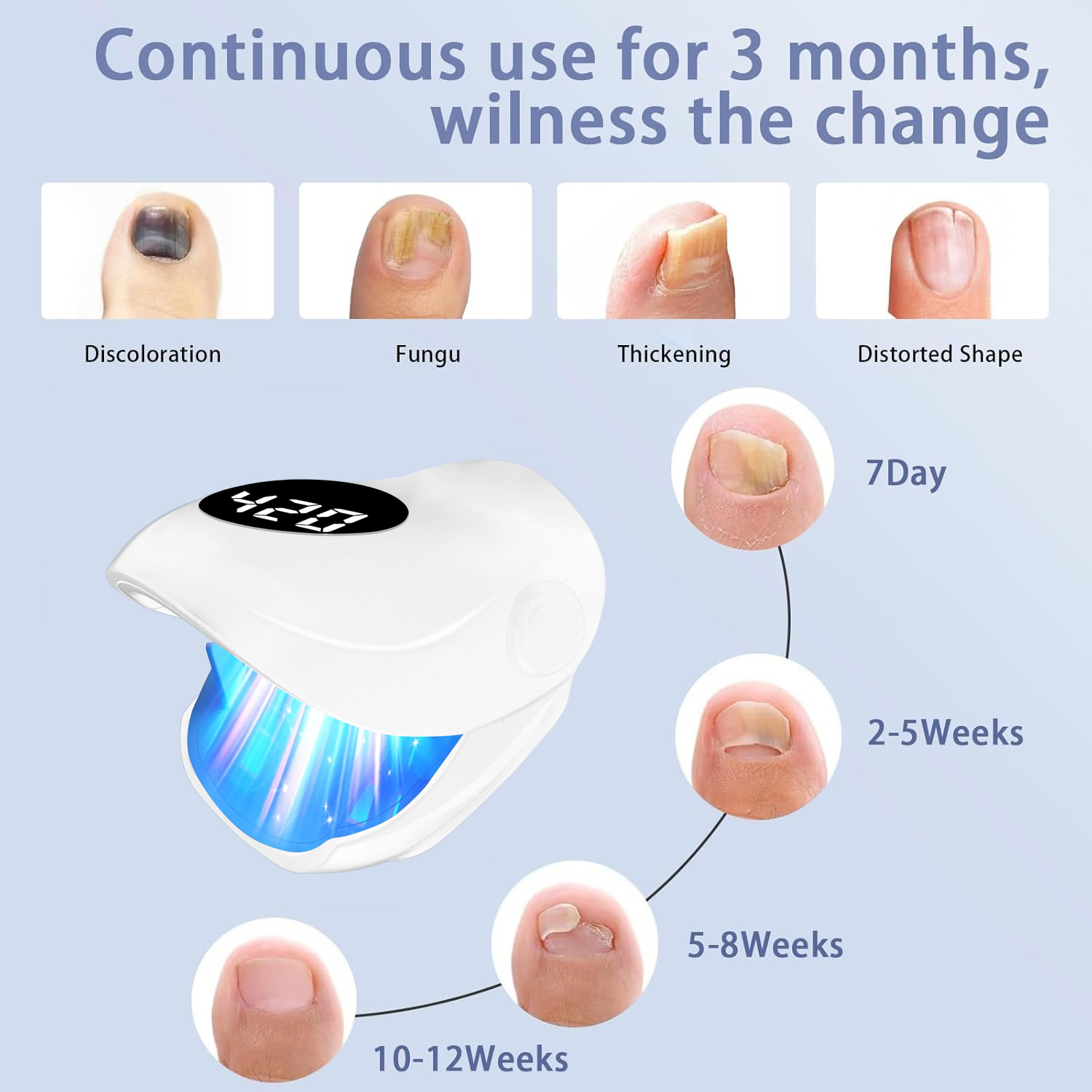 Устройство для лечения грибка  – обзор и цена Galvanic Skin Sensor